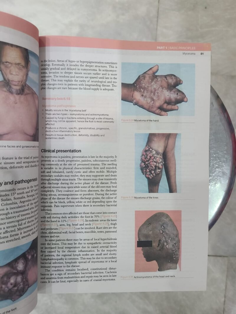 Bailey & Love's Short Practice of Surgery - 28th Edition - Image 6